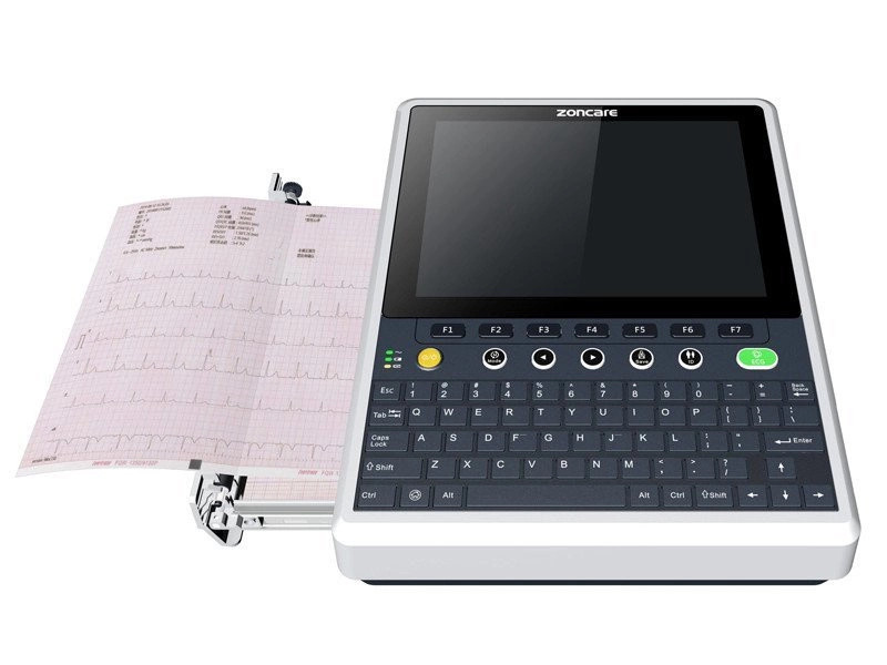 Aparat do EKG – niezbędne wyposażenie gabinetu lekarskiego